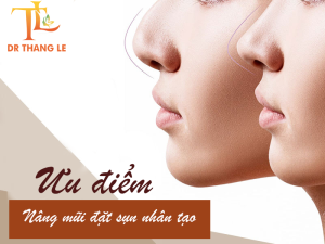 Ưu điểm của nâng mũi đặt sụn nhân tạo