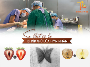 Thu nhỏ âm đạo tại Bác sĩ Thắng Lê