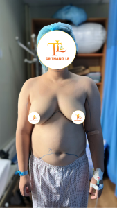 Thân hình sồ sề của chị Hoa sau khi sinh đứa thứ 2