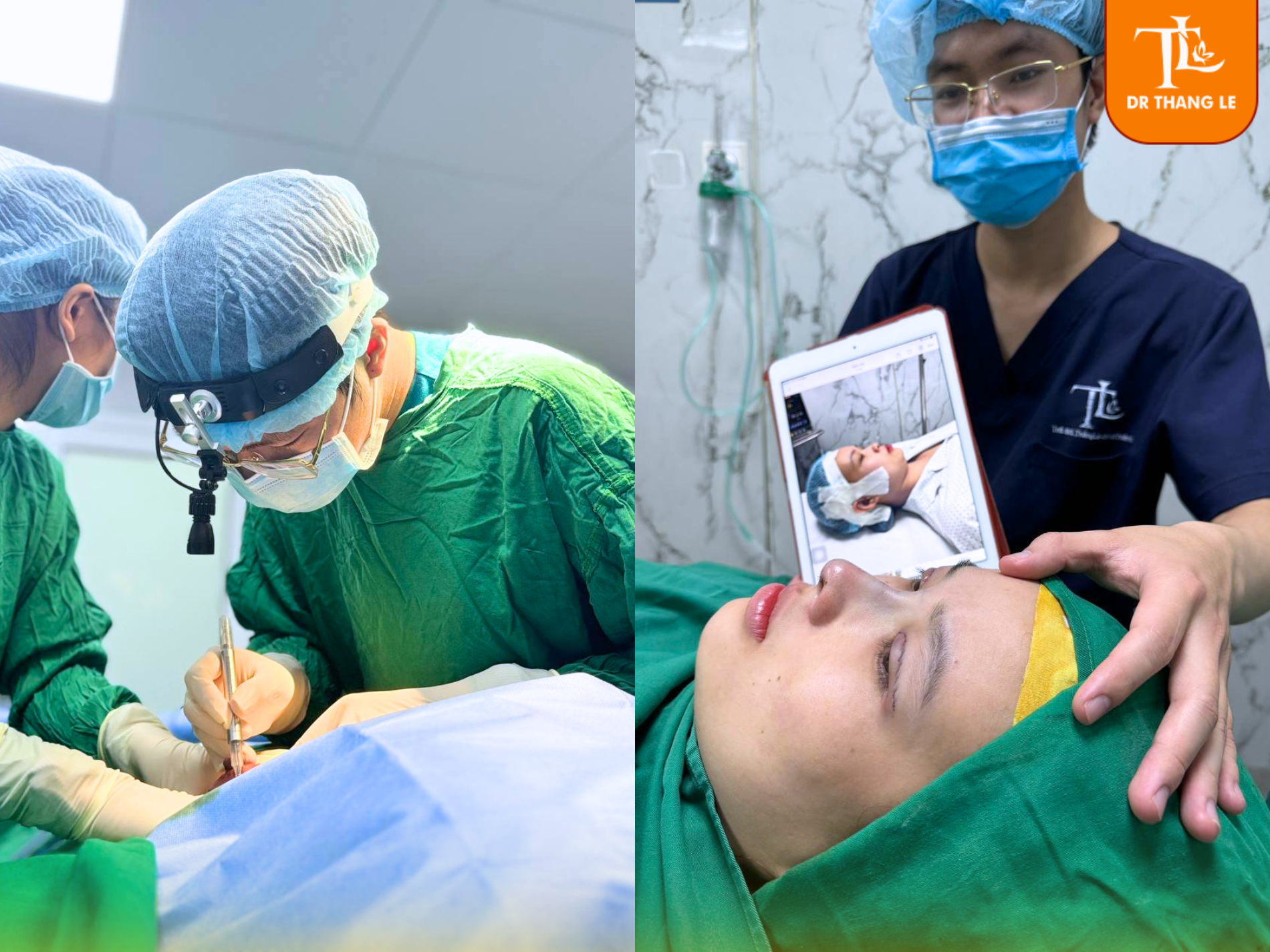 Thạc sĩ - Bác sĩ Thắng Lê trực tiếp phẫu thuật và thành quả nâng mũi cấu trúc cho khách hàng.