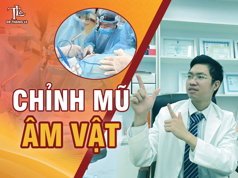 Quy trình 5 bước chỉnh mũ âm vật an toàn - hiệu quả