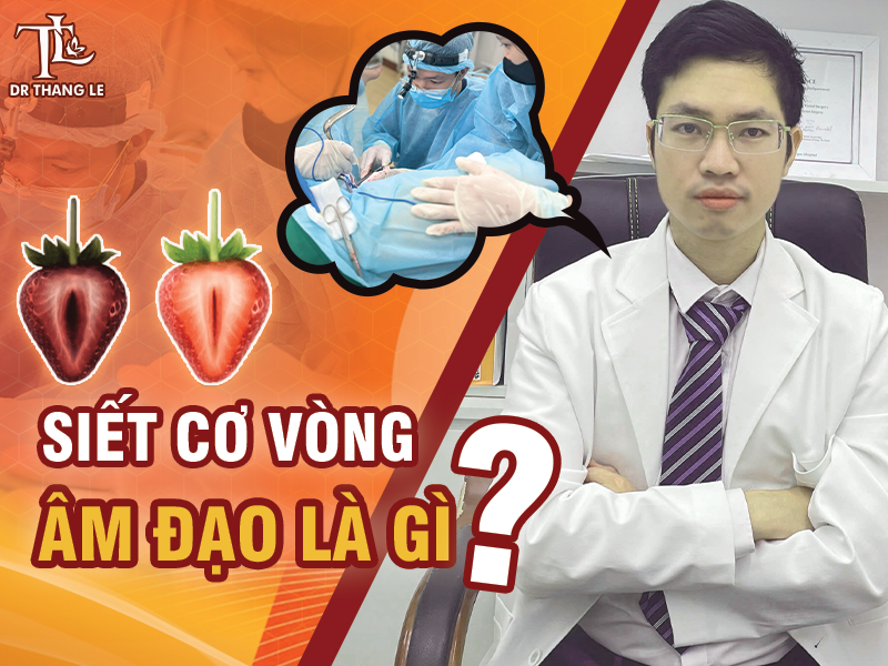 5 lưu ý khi thực hiện phẫu thuật siết cơ vòng âm đạo