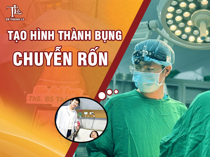 Lấy lại vòng 2 quyến rũ bằng tạo hình thành bụng chuyển rốn