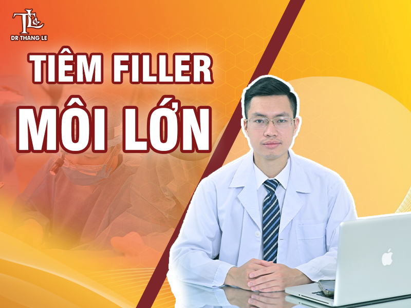 5 lợi ích của tiêm Filler môi lớn giúp chị em tự tin hơn