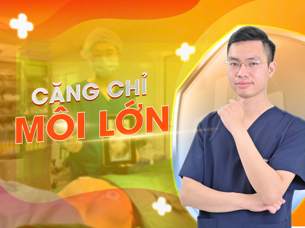 5 lý do bạn cần phải căng chỉ môi lớn ngay hôm nay