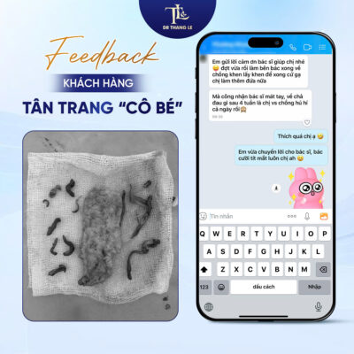 Feedback khách hàng sau tân trang cô bé tại Dr Thắng Lê