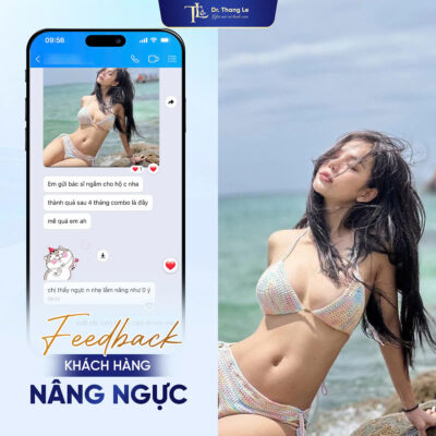 Feedback khách hàng nâng ngực tại Dr Thắng Lê