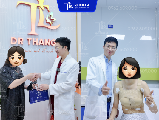 Khách hàng nâng V1 tại Dr.Thắng Lê