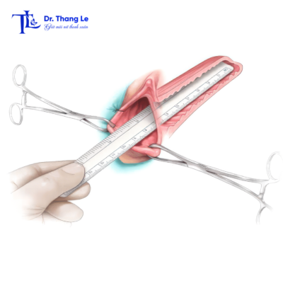 Độ sâu vùng kín thay đổi khi được kích thích