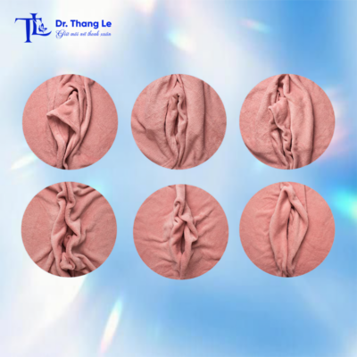 Vùng kín thay đổi theo nhiều hình